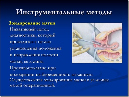 slezhyms